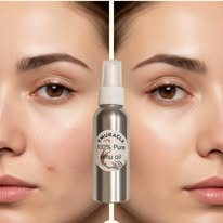 Emuracle — Huile d'émeu pure 100% | Format 100 ml | Visage, corps & cheveux