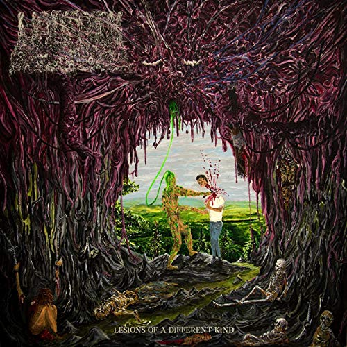 Undeath / Lesions Of A Different Kind - CD