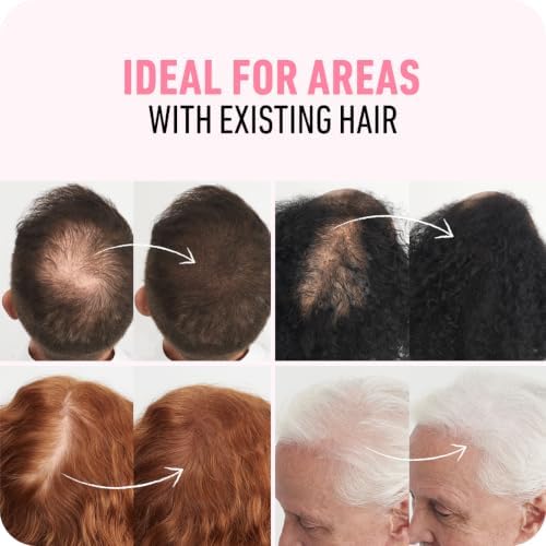 BOLDIFY Hair Fibers for Thinning Hair, for Women & Men, Dark Brown 28g|B01G4NMIZG
