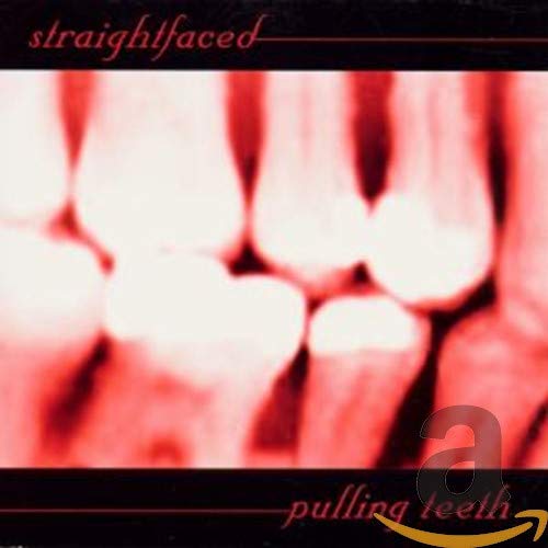 Pulling Teeth