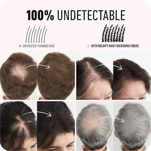 BOLDIFY Hair Fibers for Thinning Hair, for Women & Men, Dark Brown 28g|B01G4NMIZG