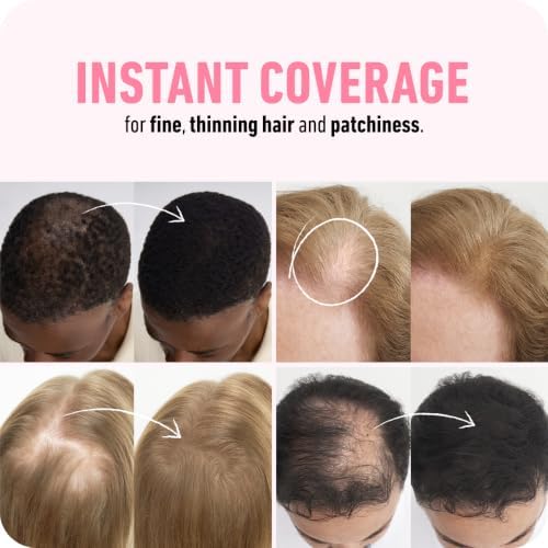BOLDIFY Hair Fibers for Thinning Hair, for Women & Men, Dark Brown 28g|B01G4NMIZG