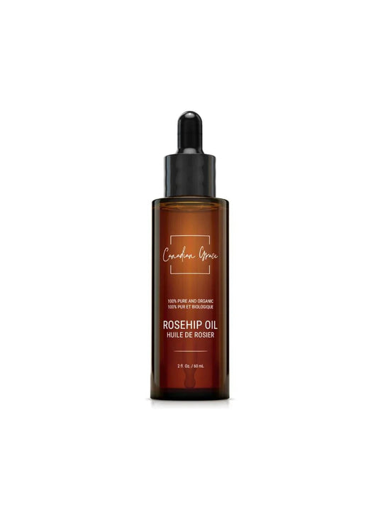 Huile de rose musquée 100 % biologique Canadian Grace – Pour les ridules, le teint irrégulier et une peau d'apparence plus lumineuse